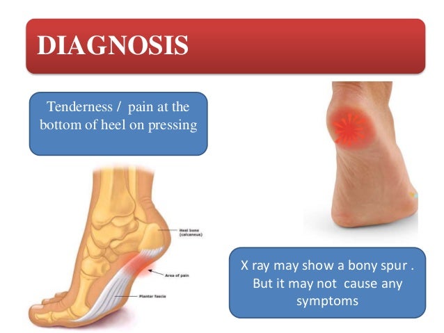 injury to bottom of heel Injury to bottom of heel